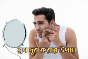 ব্রণর হাত থেকে মুক্তি পাওয়ার উপায়