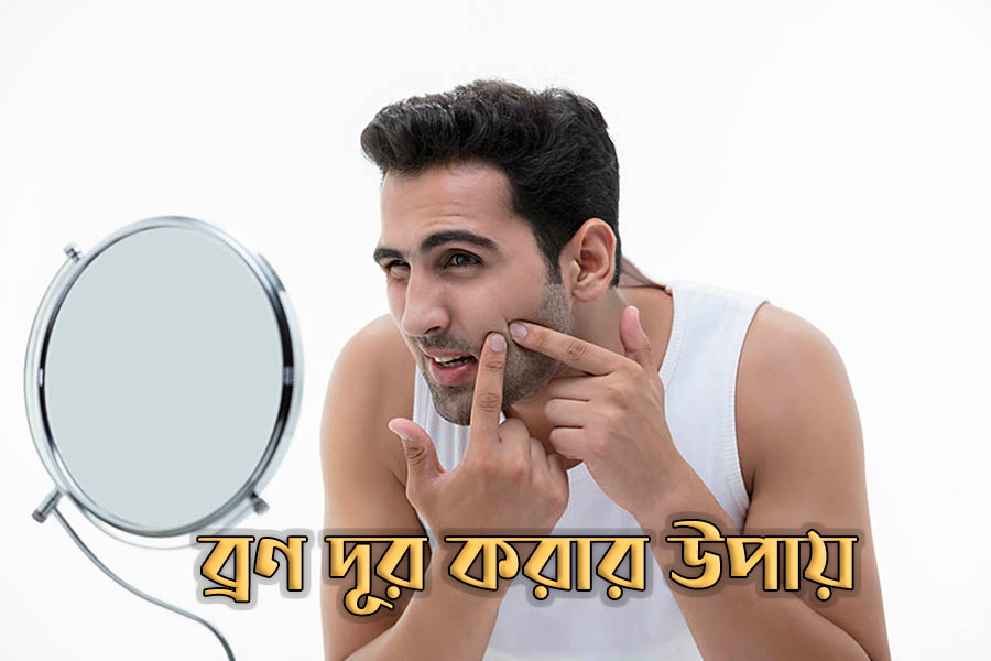 ব্রণর হাত থেকে মুক্তি পাওয়ার উপায়